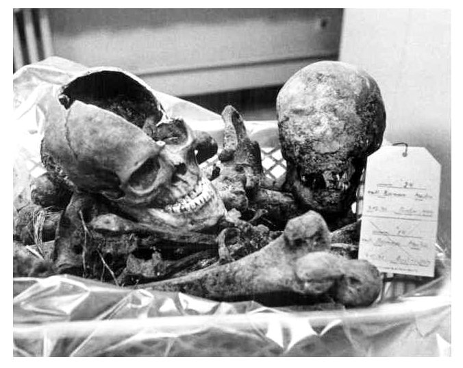 The skeletan remains of Martin Bormann (1972) - Stew Ross