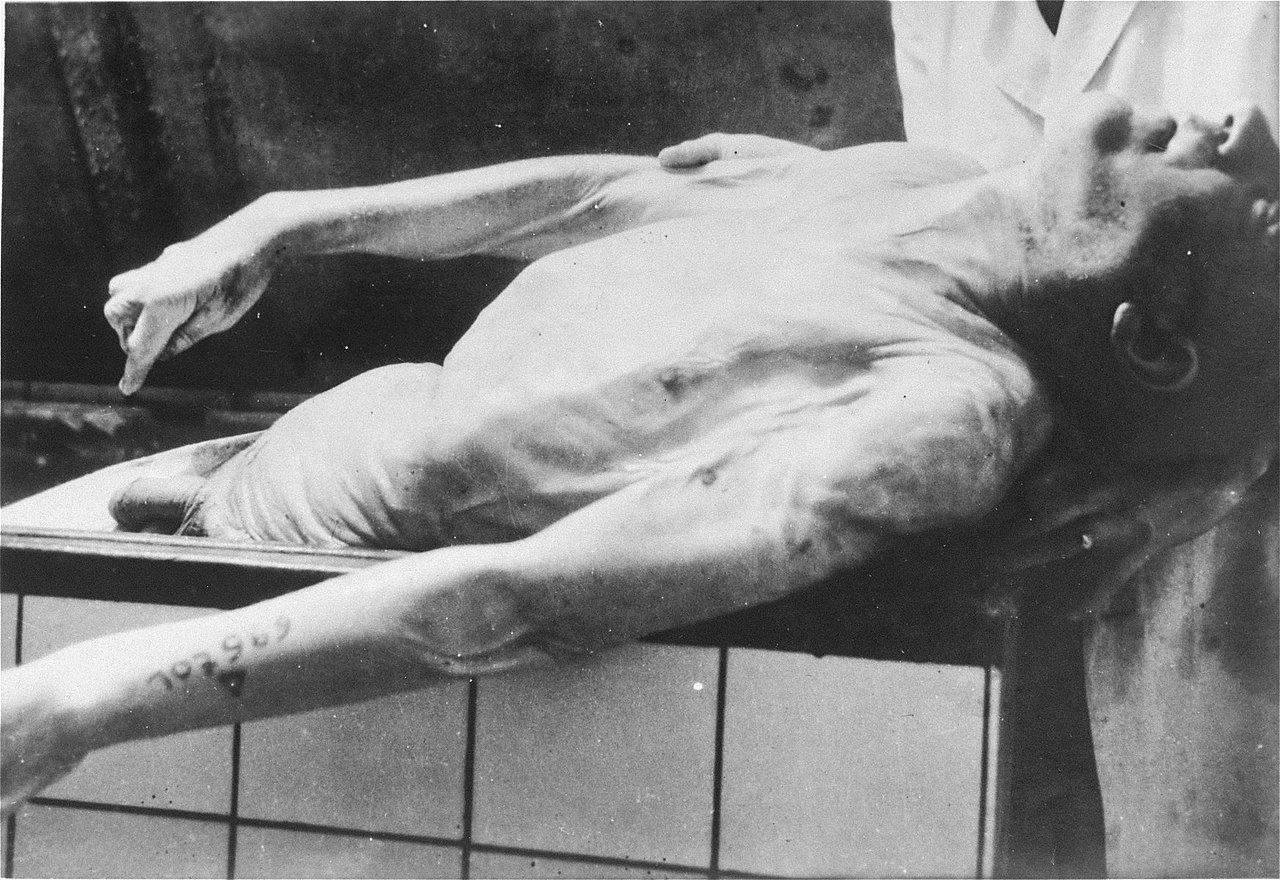 Menachem Taffel's body, part of the Jewish Skeleton Collection at Natzweiler-Struthof Camp - Public Domain